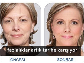 yasinizi-ele-veren-bolgeniz-kalmayacak-_293_220